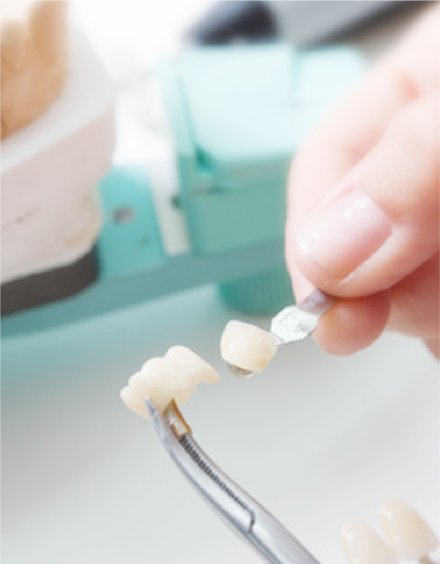 白で治療するだけで美しい口元が蘇る