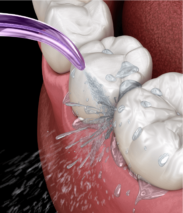 プロフェショナルクリーニング