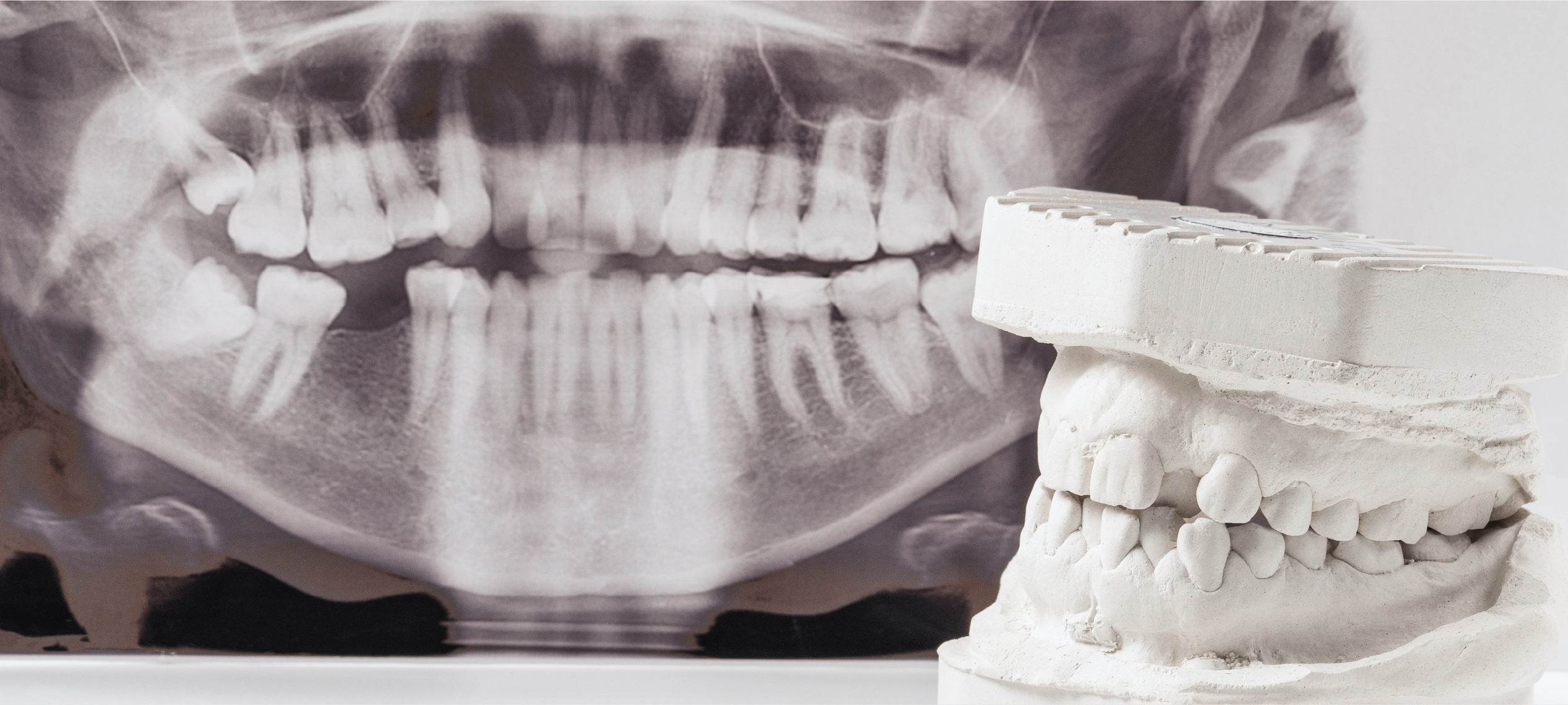 こどももおとなも歯並びを整える生活に