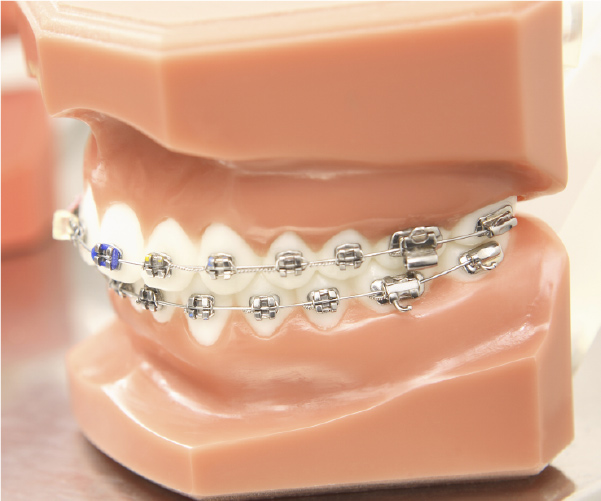 金属ブラケット