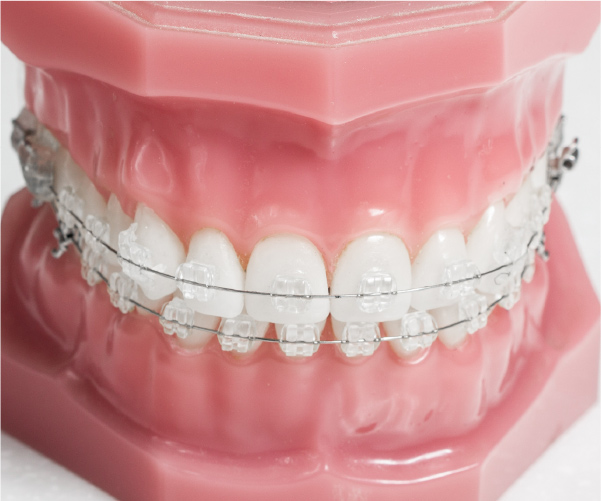 非金属ブラケット