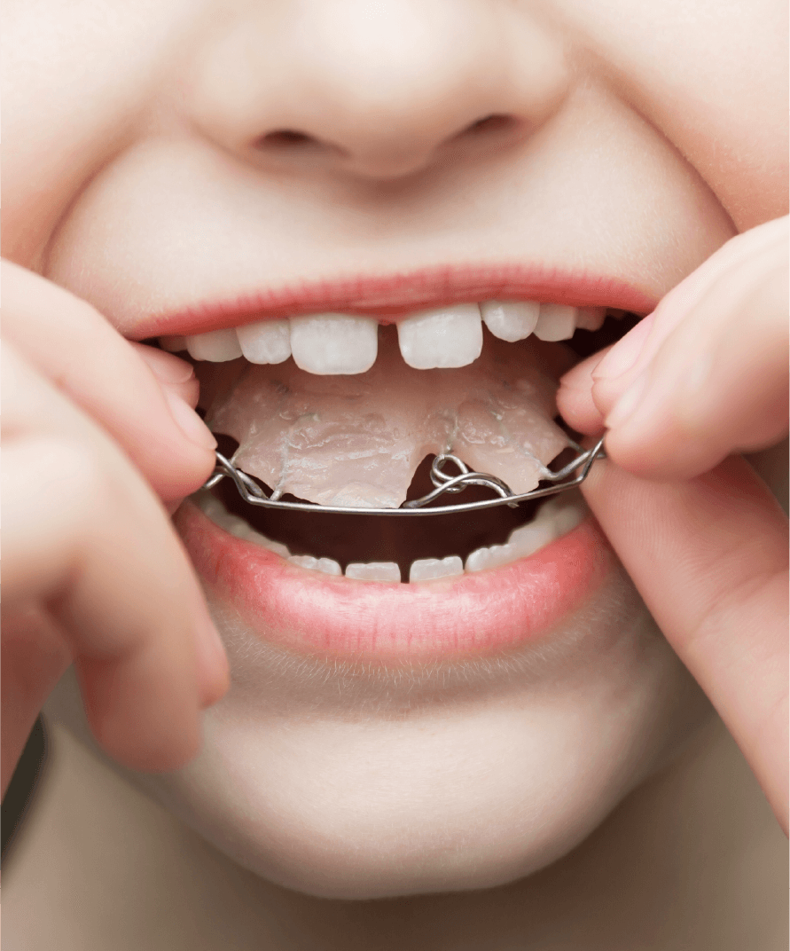 顎の成長に合わせて診察小児矯正カウンセリング